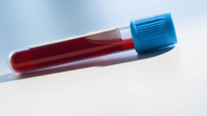Kanserin erken tespiti için kan testlerinde yeni bir yöntem bulundu
